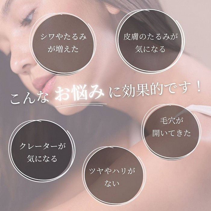 フラクショナルRF Onyx-オニキス-
